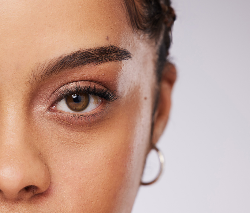 Derma Beauty Clinic - Sunken Eye Bags